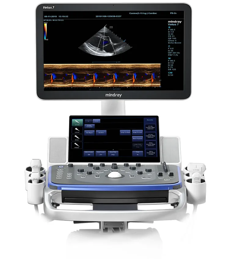 Échographe Doppler Couleur Mobile - Mindray M7